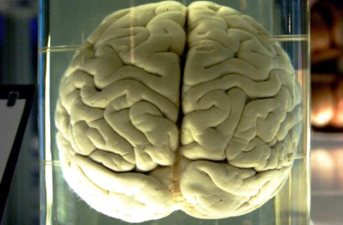 En hjärna i vatten